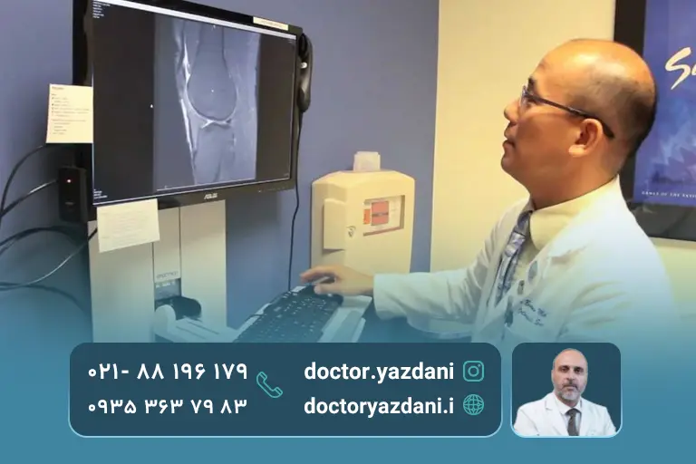 آزمایشات تصویربرداری آرتروز